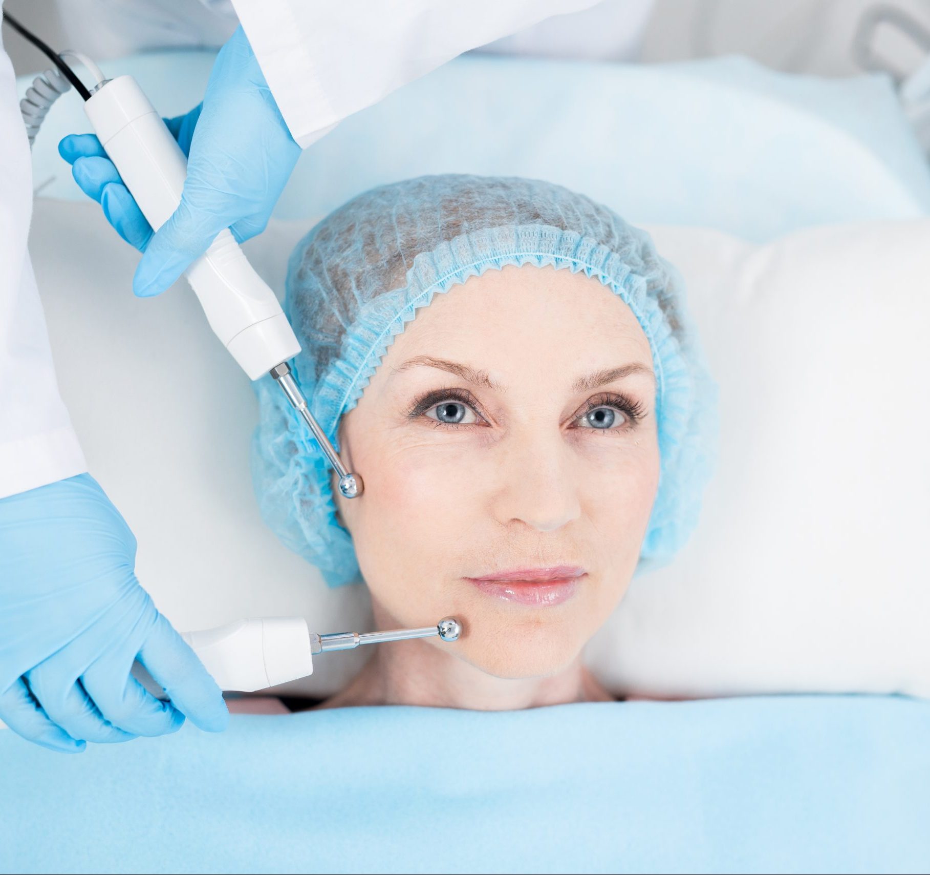 laser hair removal
